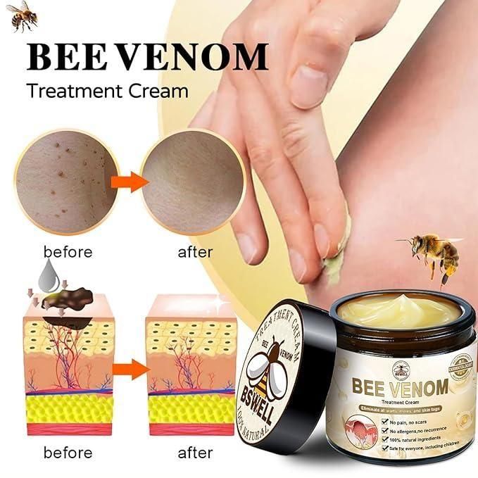 Bee Venom Skin Treatment Cream (buy 1 get 1 one free)