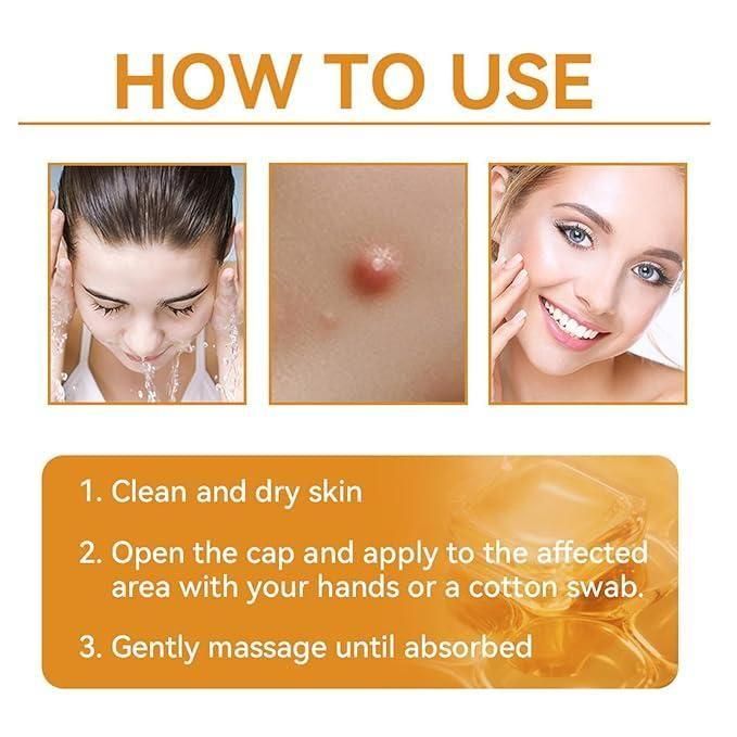 Bee Venom Skin Treatment Cream (buy 1 get 1 one free)